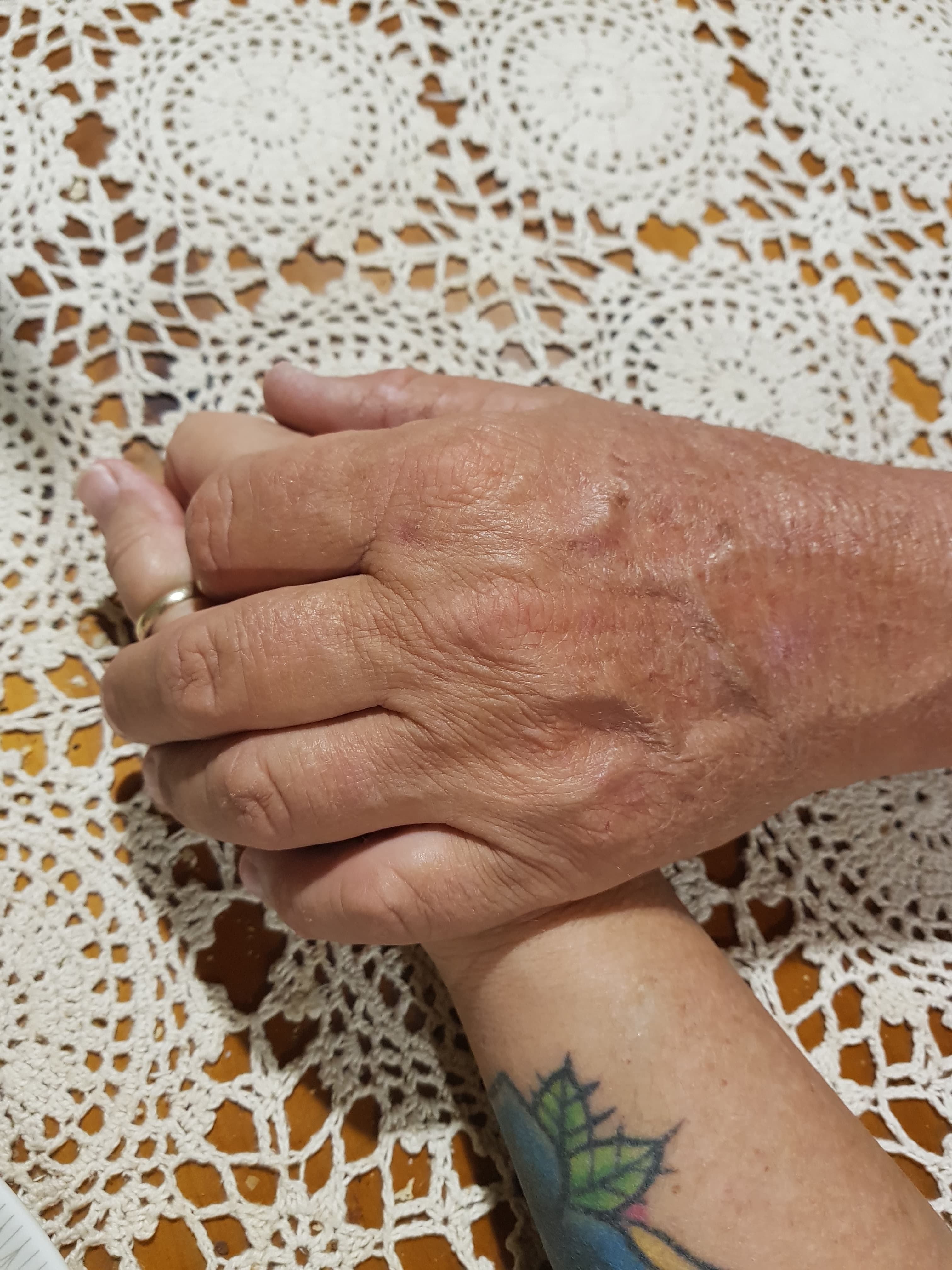 Husbands & Menopause